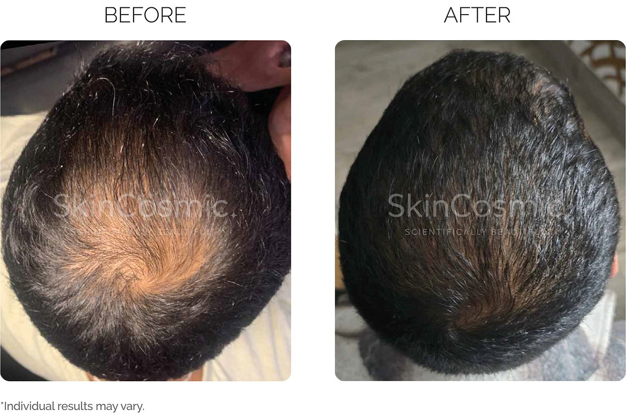 before and after