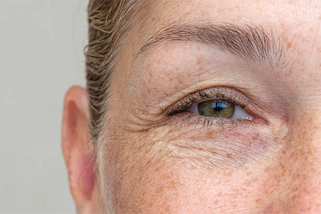ageing