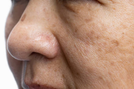 ageing
