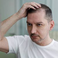 hair loss